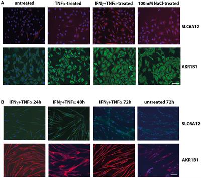 Induction of Osmolyte Pathways in Skeletal Muscle Inflammation: Novel Biomarkers for Myositis